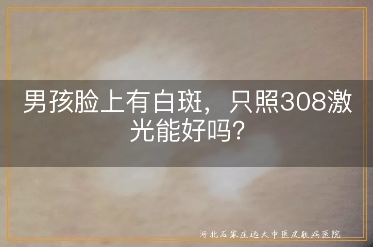 男孩白斑,308激光,白癜风,治疗效果,综合治疗