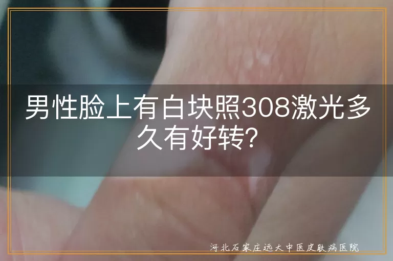 男性脸上有白块照308激光多久有好转？