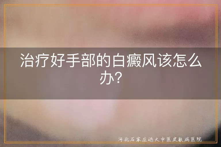 治疗好手部的白癜风该怎么办？