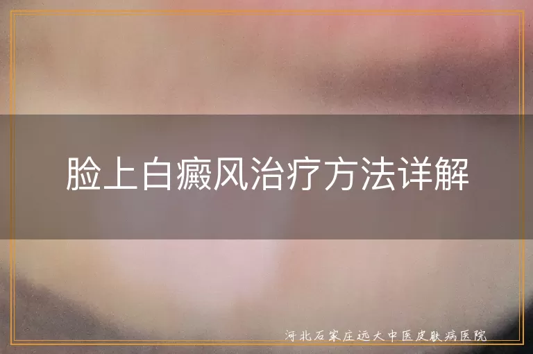 白癜风,治疗方法,科学检测,药物治疗,光疗,手术治疗,日常护理,心态调整