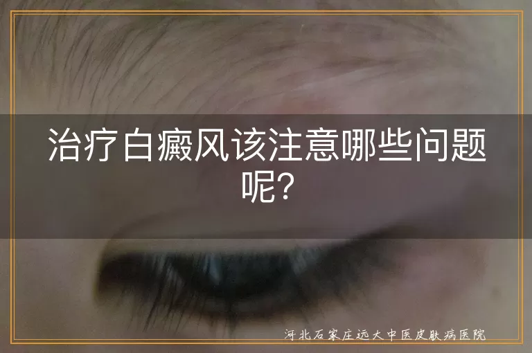治疗白癜风该注意哪些问题呢？