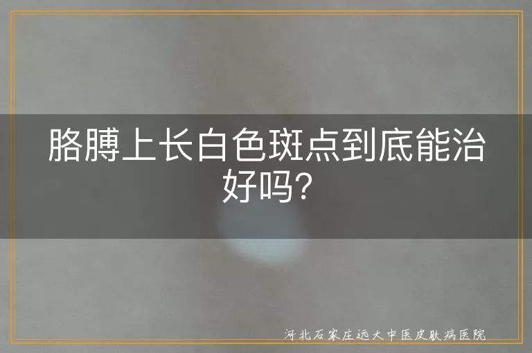 胳膊上长白色斑点到底能治好吗？