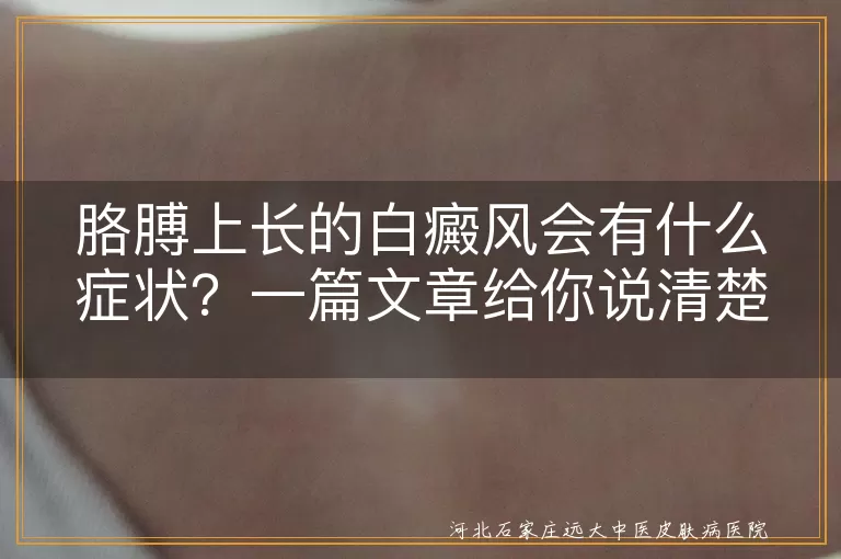 胳膊上长的白癜风会有什么症状？一篇文章给你说清楚！