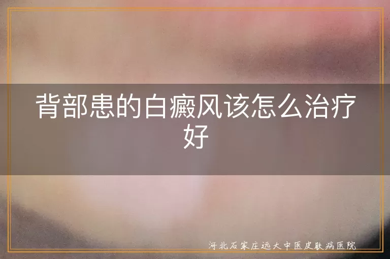 背部白癜风,治疗方法,药物治疗,光疗,心理调适,预防复发
