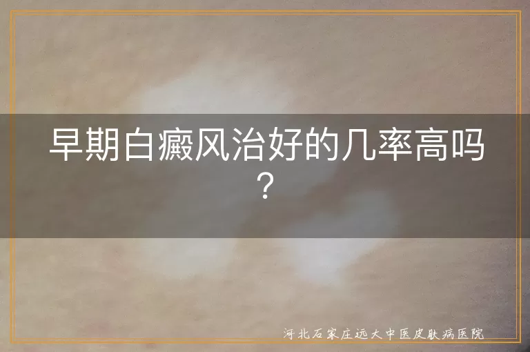 早期白癜风,治愈率,早发现早治疗,治疗方法,生活习惯