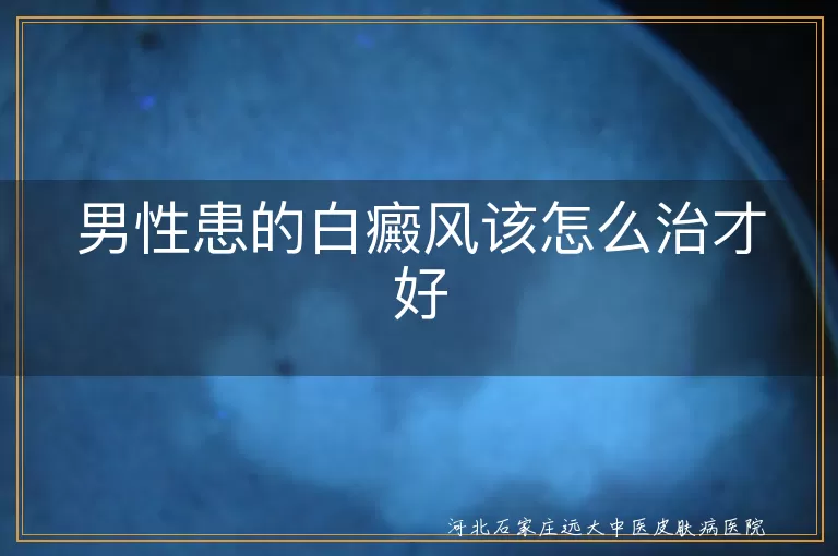 男性患的白癜风该怎么治才好