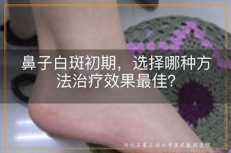 鼻子白斑初期，选择哪种方法治疗效果最佳？