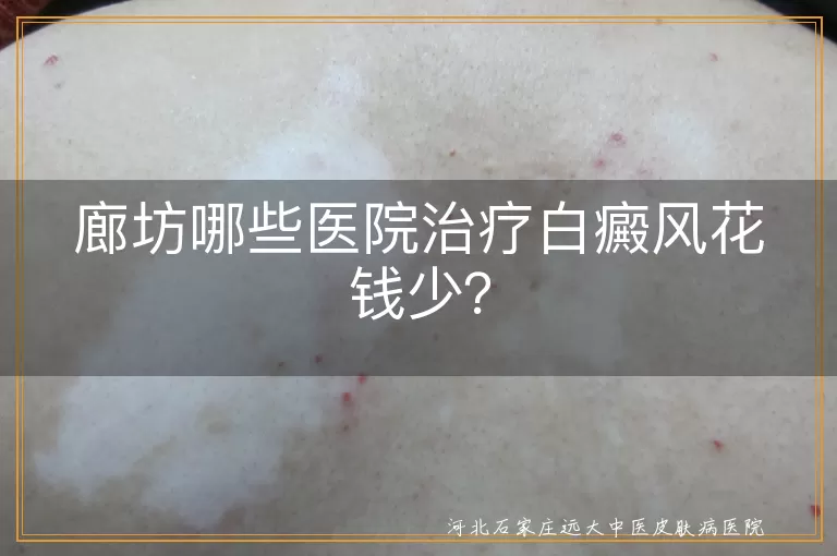 廊坊,白癜风治疗,公立医院,医保定点,专科医院,省钱技巧