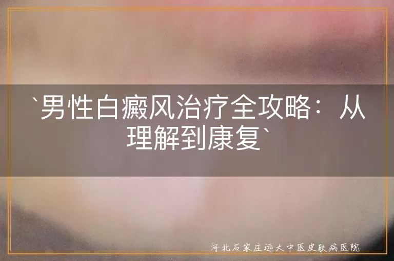 男性白癜风治疗全攻略：从理解到康复