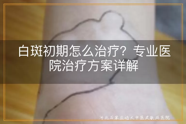 白斑初期,专业医院,治疗方案,药物治疗,光疗,手术治疗,中医治疗,日常护理,积极心态