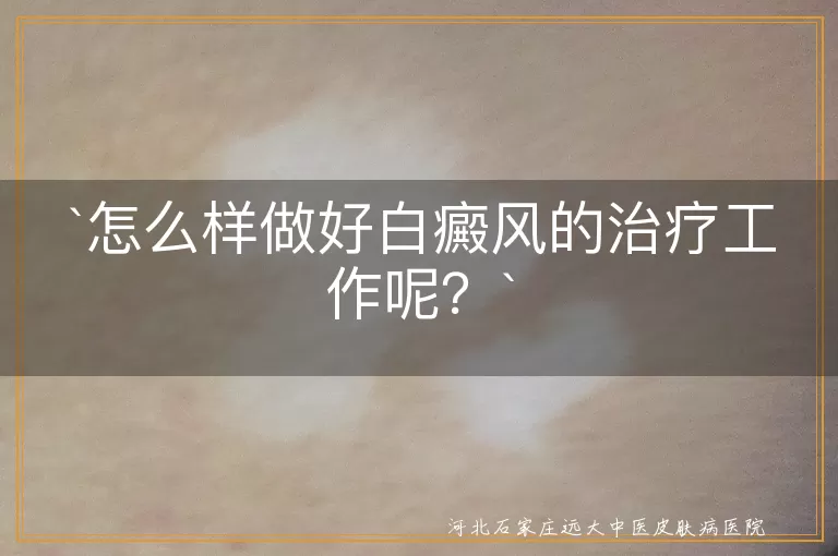 怎么样做好白癜风的治疗工作呢？