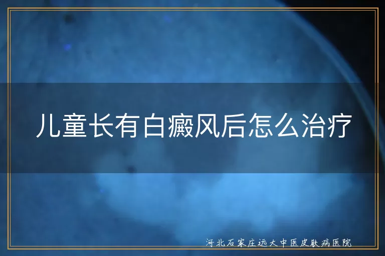 儿童白癜风,早期治疗,综合治疗,一般治疗,药物治疗,光疗,手术治疗,日常护理,心理疏导,坚持治疗,定期复查