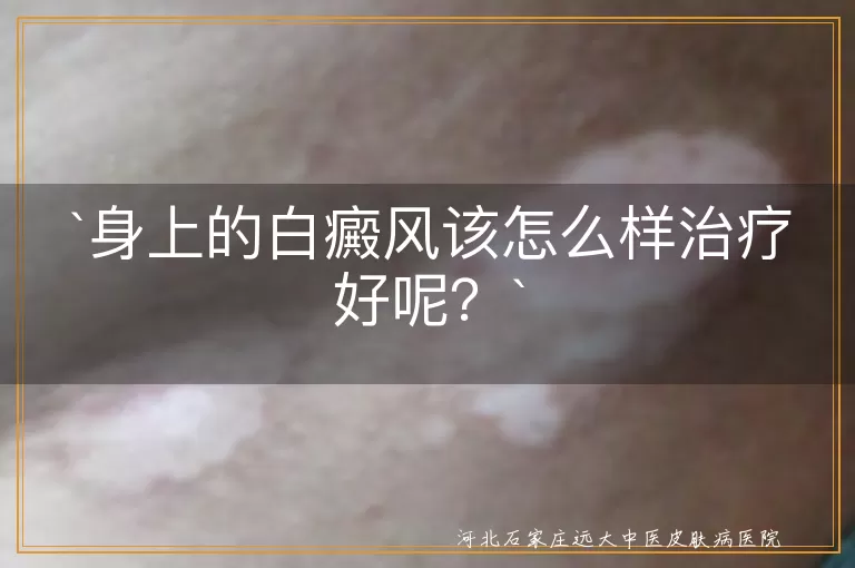 身上的白癜风该怎么样治疗好呢？