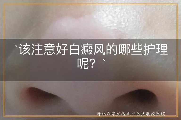 该注意好白癜风的哪些护理呢？