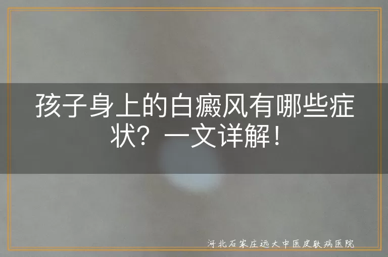 孩子身上的白癜风有哪些症状？一文详解！