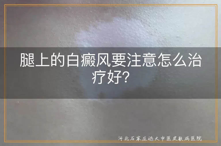 白癜风,腿部,治疗,药物,光疗,激光,手术,护理,心态,生活小贴士