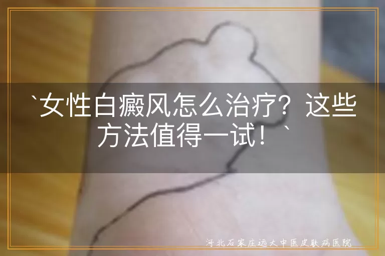女性白癜风怎么治疗？这些方法值得一试！
