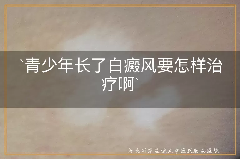 青少年长了白癜风要怎样治疗啊