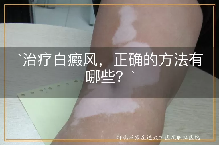 治疗白癜风，正确的方法有哪些？