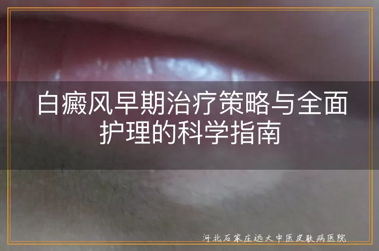 白癜风,早期治疗,药物治疗,光疗,手术治疗,全面护理,防晒,合理饮食,适当运动