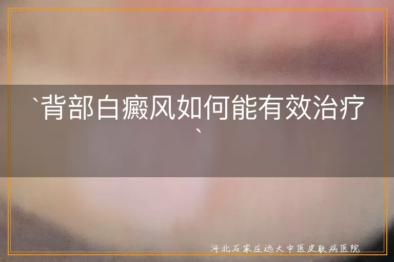 背部白癜风如何能有效治疗