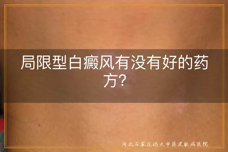 局限型白癜风,药方,中药治疗,西药治疗,物理治疗,手术治疗,日常护理