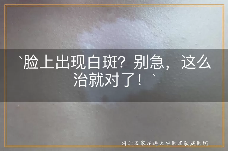 脸上出现白斑？别急，这么治就对了！