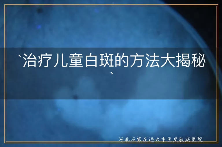 儿童白斑,治疗,外用药物,口服药物,光疗,激光治疗,生物反馈疗法,中医中药,生活调理
