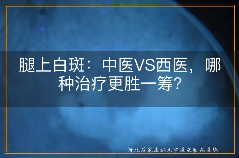 腿上白斑,中医治疗,西医治疗,综合疗法,生活习惯调整