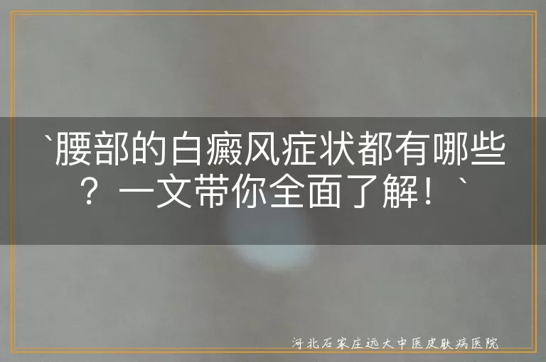 腰部白癜风,白斑扩散,毛发变白,皮肤敏感,心理压力,及时就医