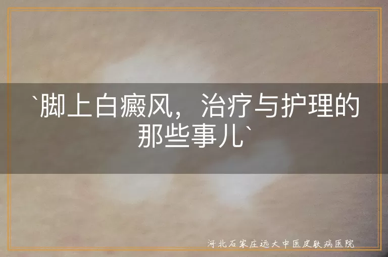 脚上白癜风,治疗,护理,就医,科学治疗,日常护理,预防复发