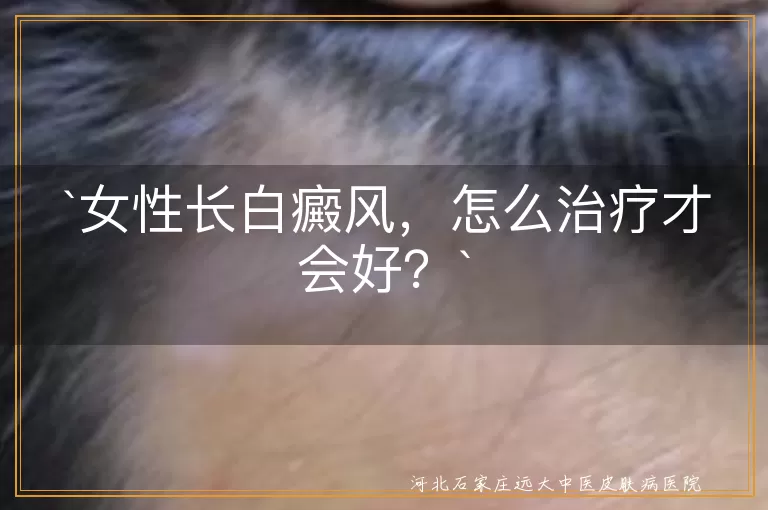 女性长白癜风，怎么治疗才会好？