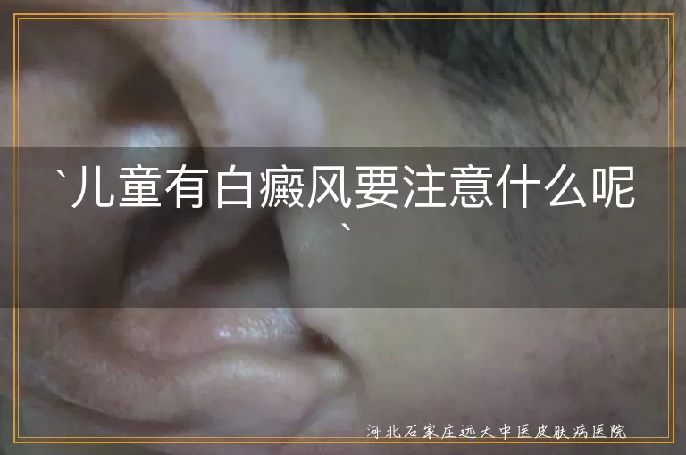 儿童有白癜风要注意什么呢