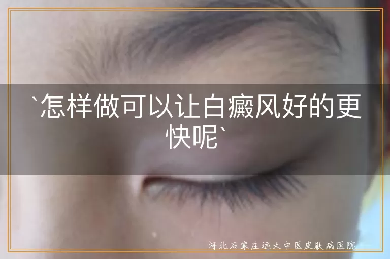 怎样做可以让白癜风好的更快呢
