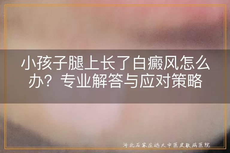 白癜风,小孩子,治疗,护理,预防,心理健康