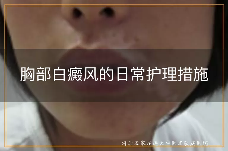 胸部白癜风,护理措施,皮肤保护,饮食调整,情绪调节,防晒,规范用药,适当锻炼