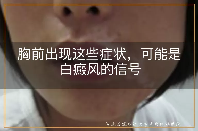 胸前白癜风,皮肤颜色变化,白斑扩散,毛发变白,皮肤感觉异常,对阳光敏感,及时就医