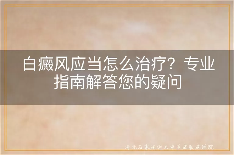 白癜风应当怎么治疗？专业指南解答您的疑问