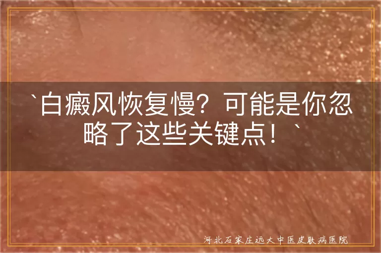 白癜风恢复慢？可能是你忽略了这些关键点！