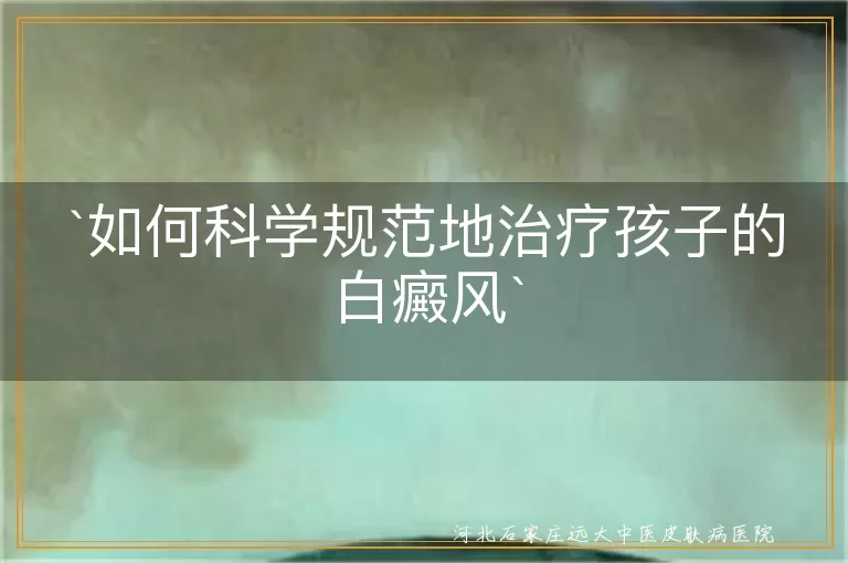 如何科学规范地治疗孩子的白癜风