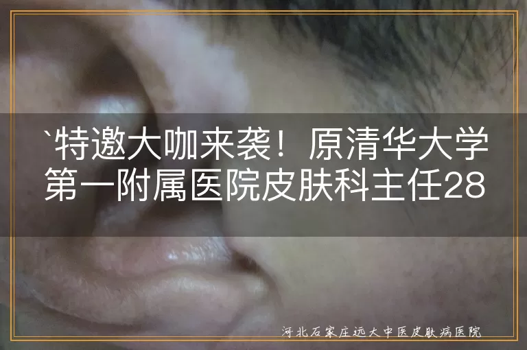 特邀大咖来袭！原清华大学第一附属医院皮肤科主任28-29日亲临我院会诊