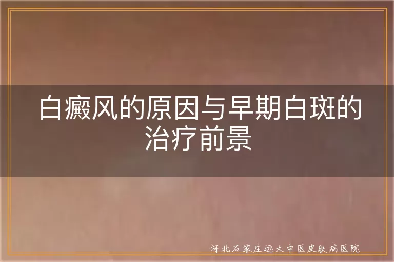白癜风的原因与早期白斑的治疗前景