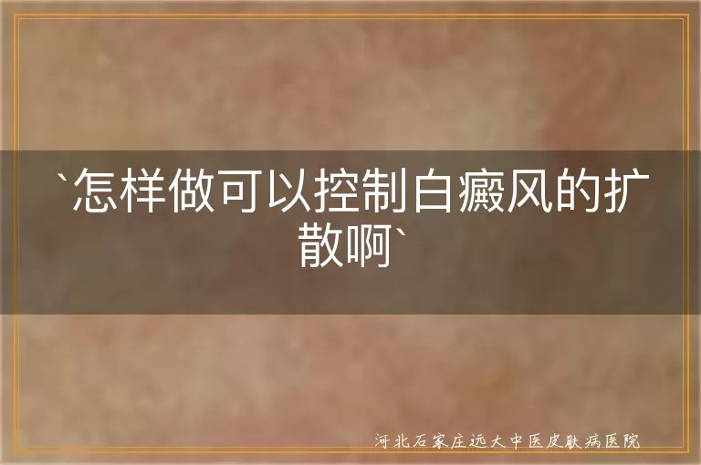 怎样做可以控制白癜风的扩散啊