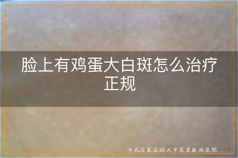 脸上有鸡蛋大白斑怎么治疗正规