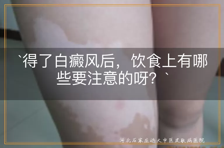 得了白癜风后，饮食上有哪些要注意的呀？