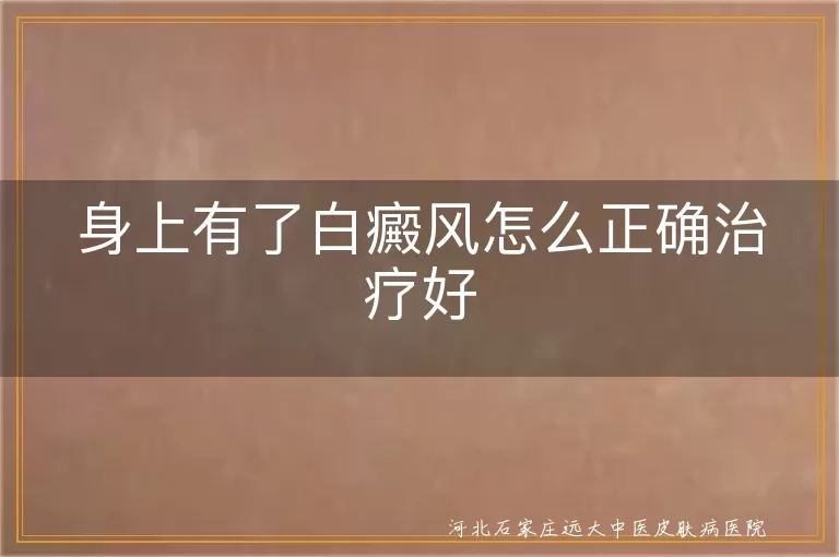 白癜风,个性化治疗,综合治疗,防晒,饮食均衡,心态,手术治疗,光疗,药物治疗,中医治疗