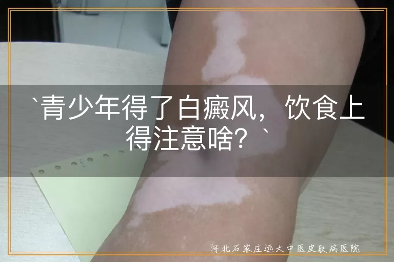 青少年,白癜风,饮食禁忌,均衡营养,辛辣刺激性食物,海鲜发物,维生素C,多喝水,饮食卫生