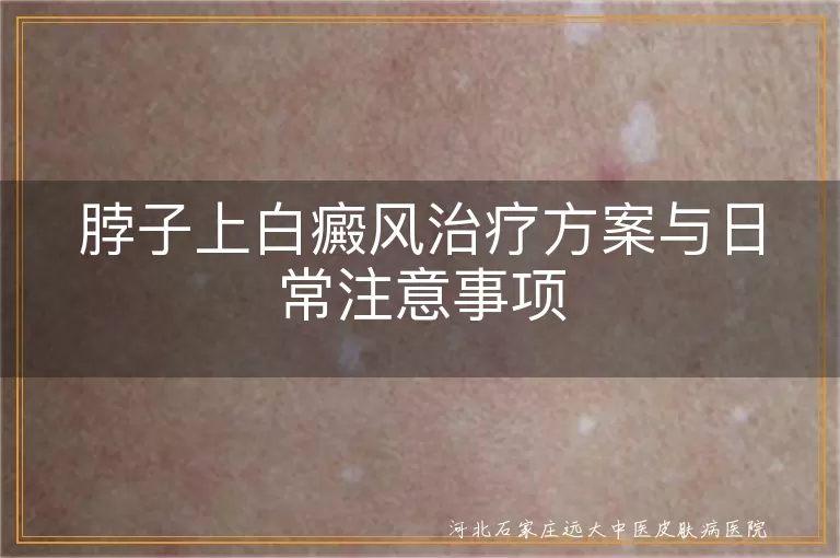 白癜风,脖子,治疗方案,药物治疗,光疗,手术治疗,防晒,合理饮食,情绪管理,定期复查