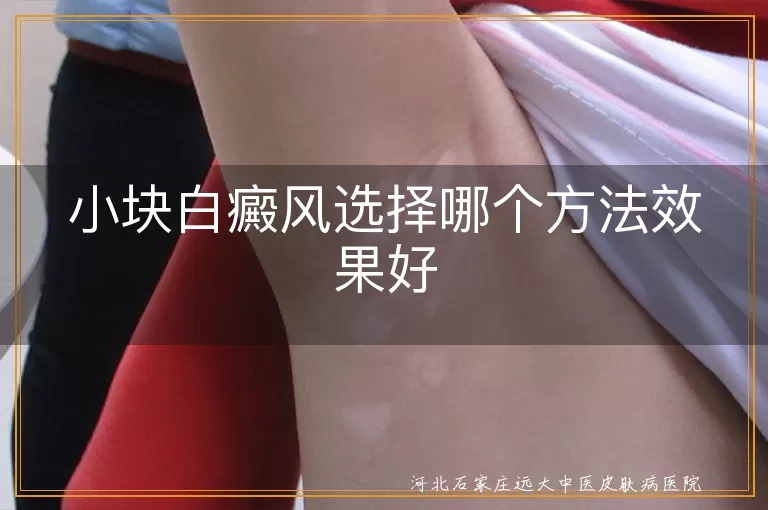 小块白癜风,药物治疗,光疗,手术治疗,生活习惯调整,心理治疗,个性化治疗