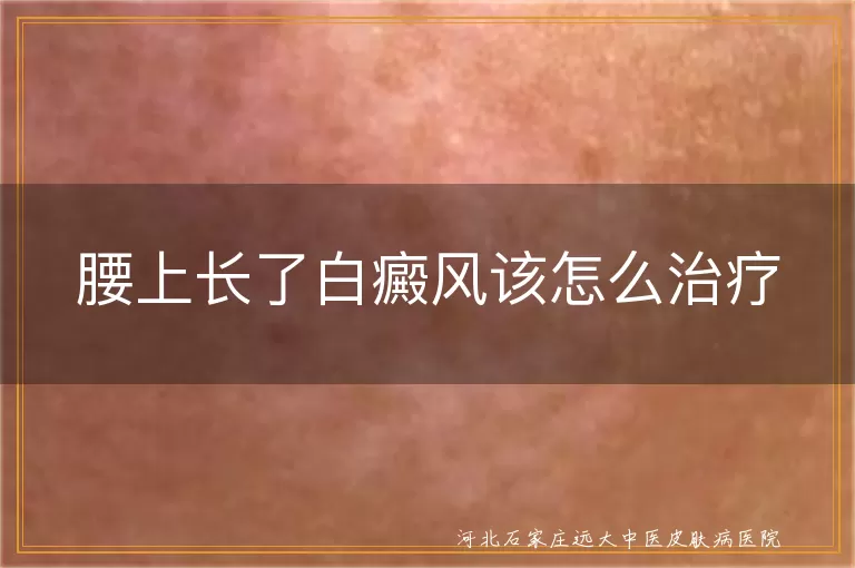 白癜风,腰上,治疗,药物,光疗,手术,防晒,生活习惯